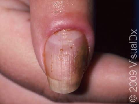 Listen to Your Nails: Recognizing Signs & When to Seek Help After Visiting the Best Nails Salon in Missouri City, TX 77459 3 Nails Salon in Missouri City, TX 77459